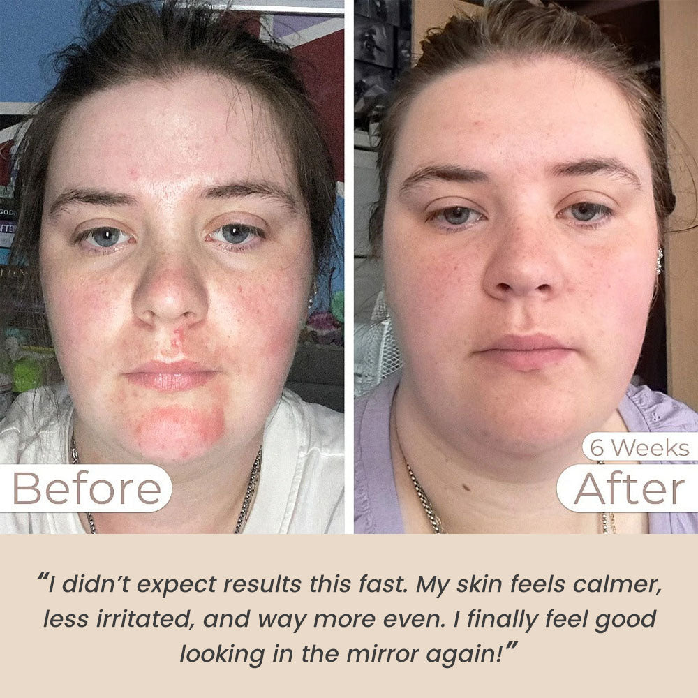 Light Therapy Face Mask