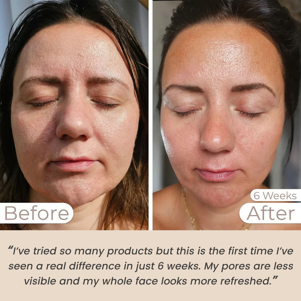 Light Therapy Face Mask