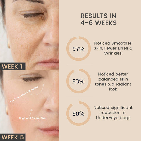 AntiGrow™ Light Therapy Mask