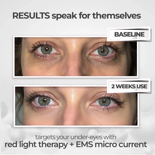 Eye Beauty Glasses™