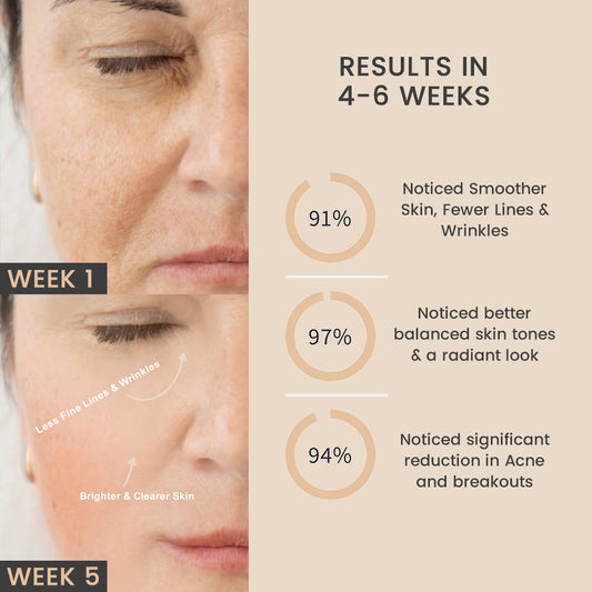 Light Therapy Face Mask