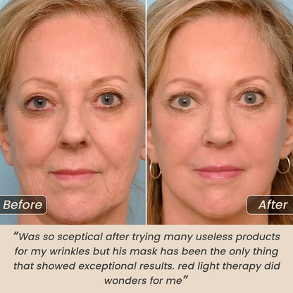 AntiGrow™ Light Therapy Mask