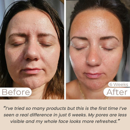 Light Therapy Face Mask