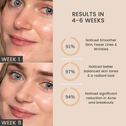 Light Therapy Face Mask